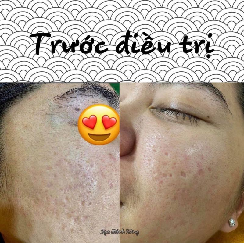 Spa Minh Hằng- Đại Lý phân phối Obagi Việt Nam