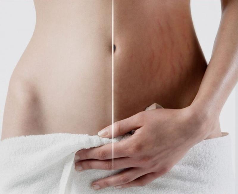 ﻿﻿Spa Muối Hồng