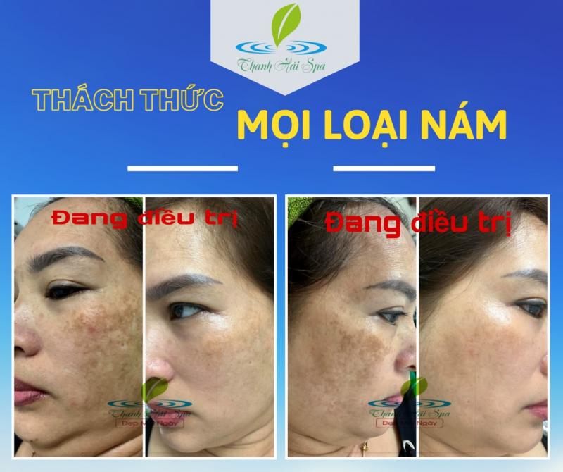 Spa Thanh Hải - Đà Nẵng