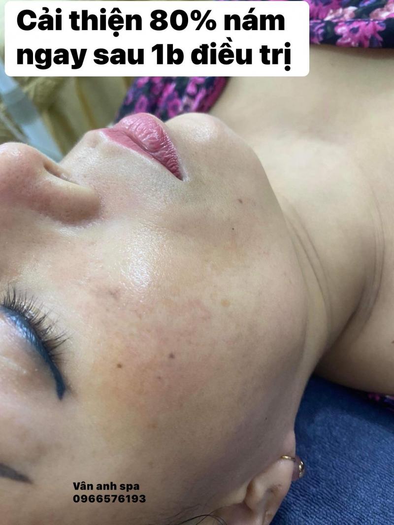 Spa Vân Anh