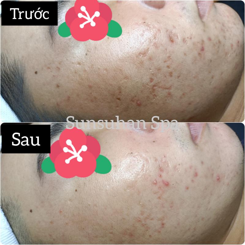 Sunsuhan Spa Cần Thơ