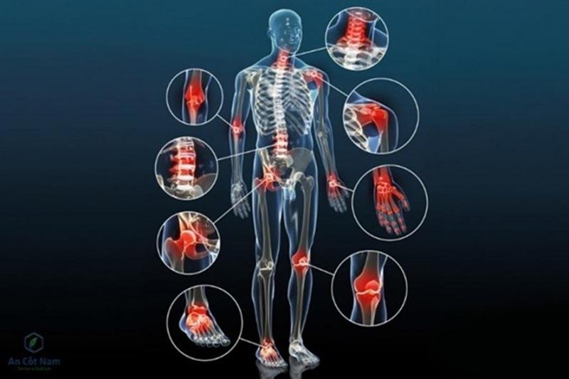 Sản phẩm có công dụng điều trị triệu chứng của thoái hóa khớp