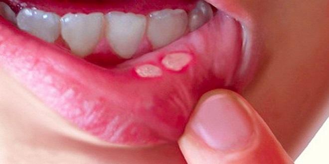 Tác dụng phụ của sản phẩm