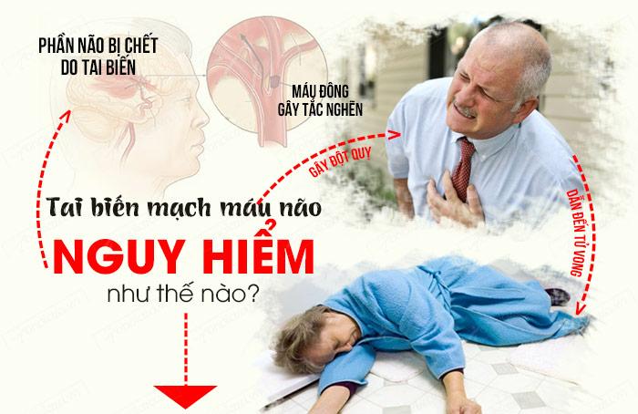 Tai biến là căn bệnh nguy hiểm