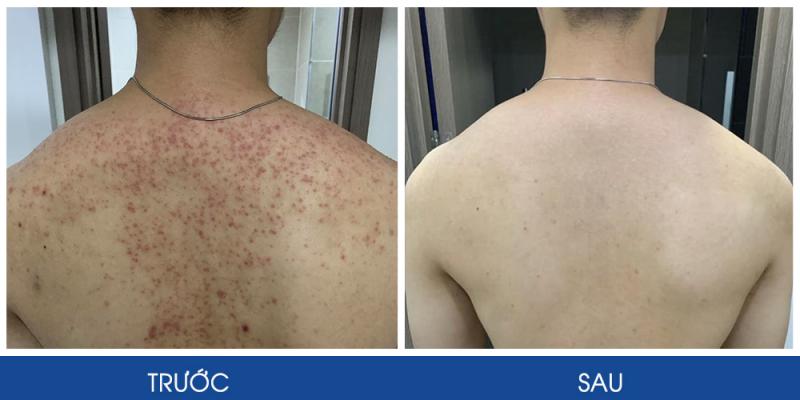 Taza Skin Clinic Đà Nẵng