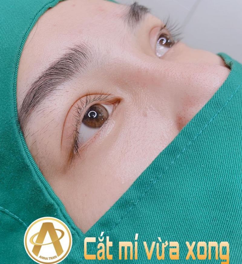 Thẩm Mỹ Anna Tran