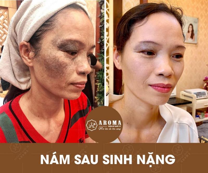 Thẩm mỹ AROMA