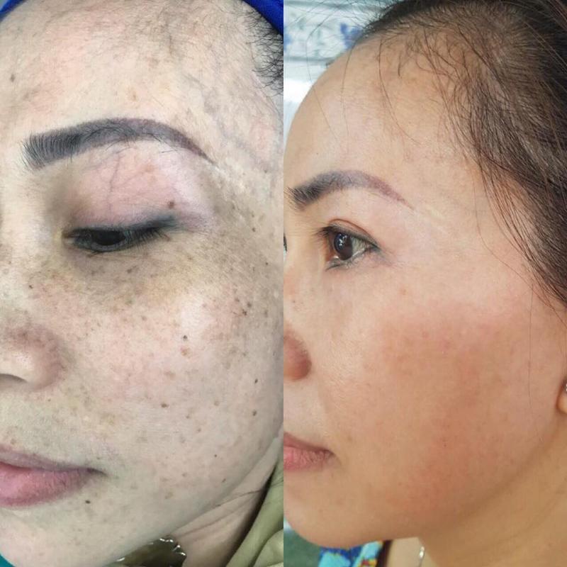 Thẩm Mỹ Bảo An