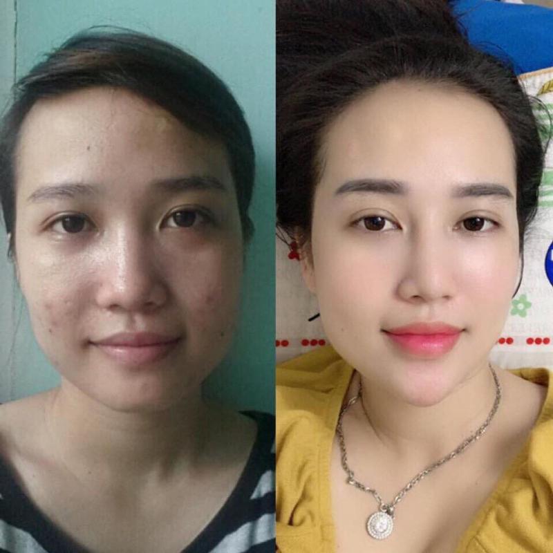 Thẩm Mỹ Bảo An