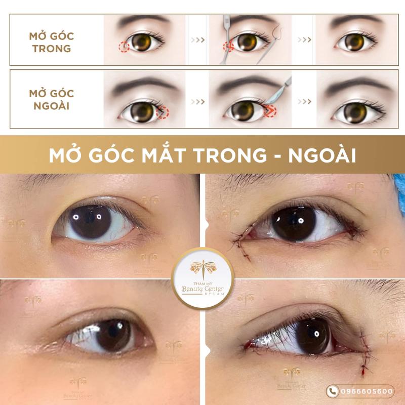 Thẩm mỹ Beauty Center By ﻿Tấm