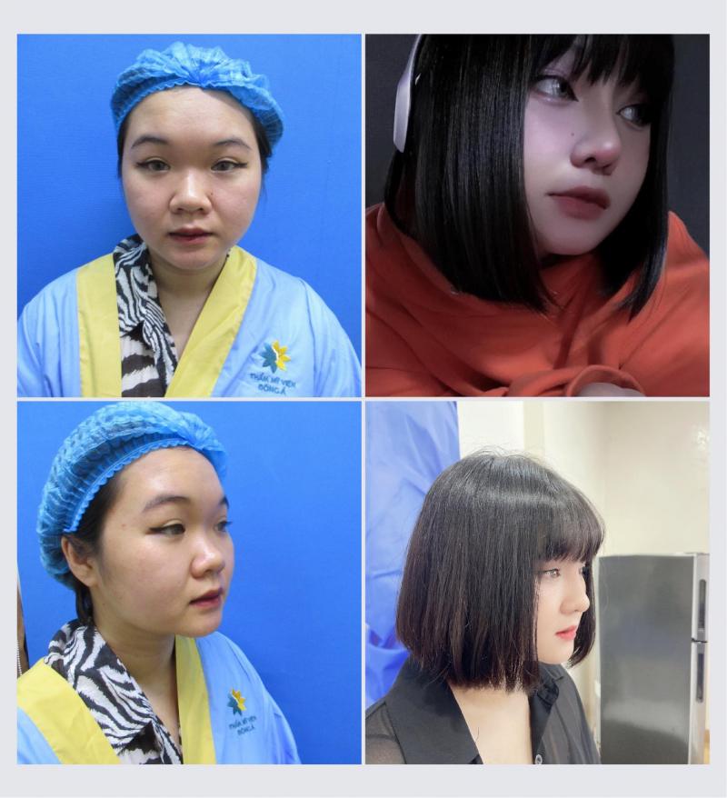 Thẩm Mỹ Đông Á - CN Đà Nẵng