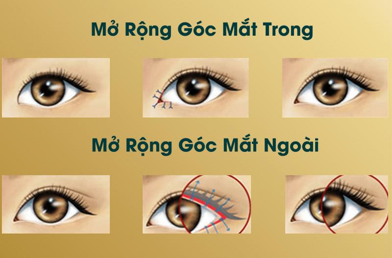 Thẩm mỹ Dr Vương