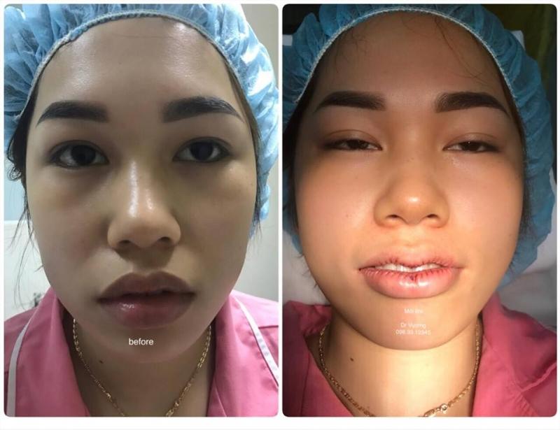 Thẩm mỹ Dr Vương