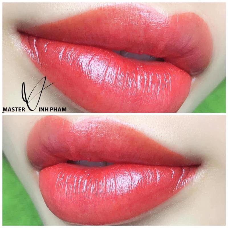 Thẩm mỹ Emmy Quảng Ngãi