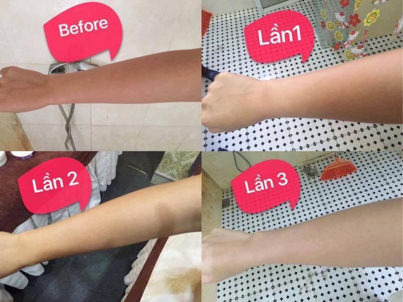 Thẩm Mỹ Emmy Huế