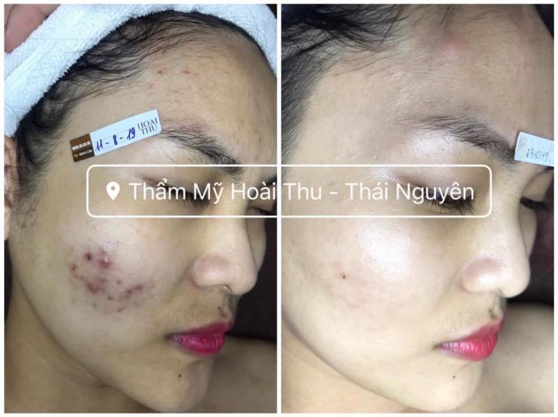 Thẩm Mỹ Hoài Thu