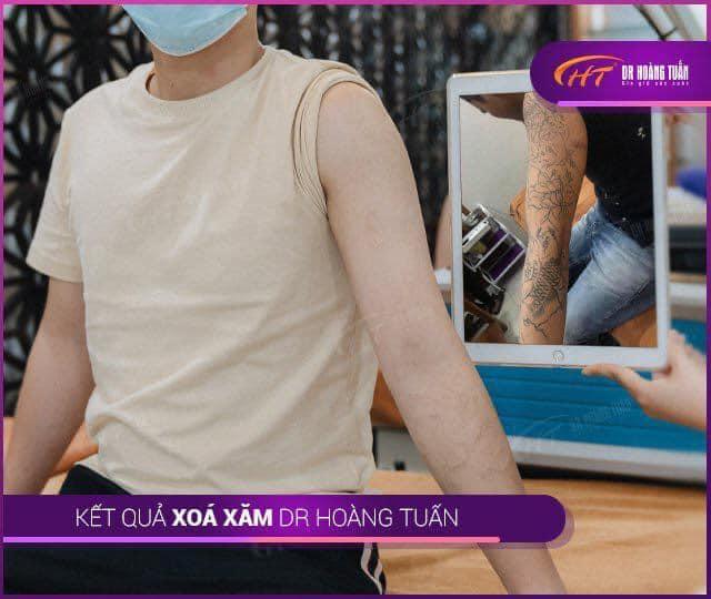 Thẩm mỹ Hoàng Tuấn