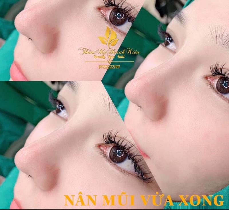 Thẩm Mỹ Hoanh Kiều