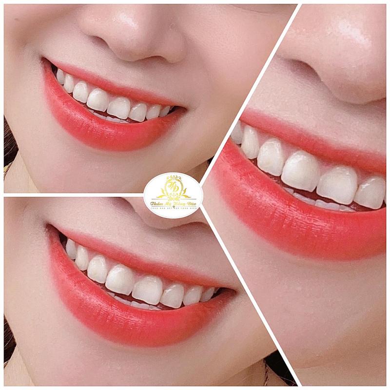 Thẩm mỹ Hồng Đào