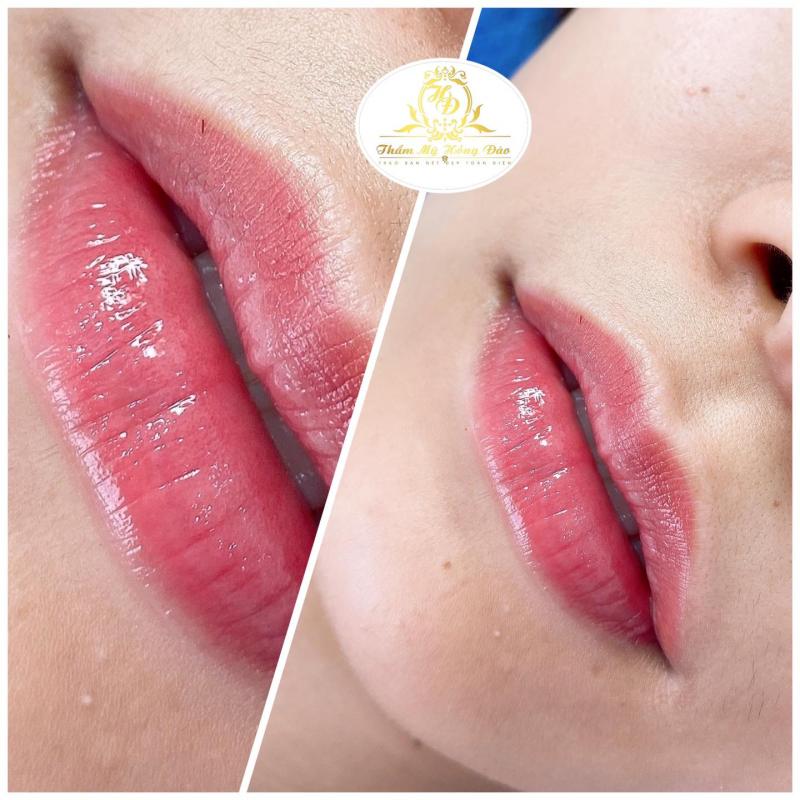 Thẩm mỹ Hồng Đào
