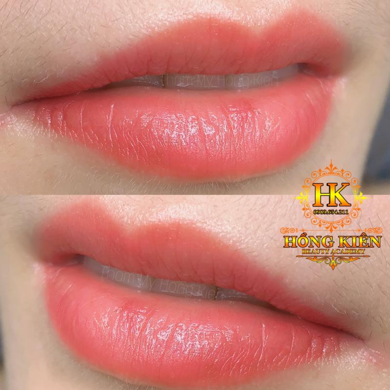 Thẩm Mỹ Hồng Kiên