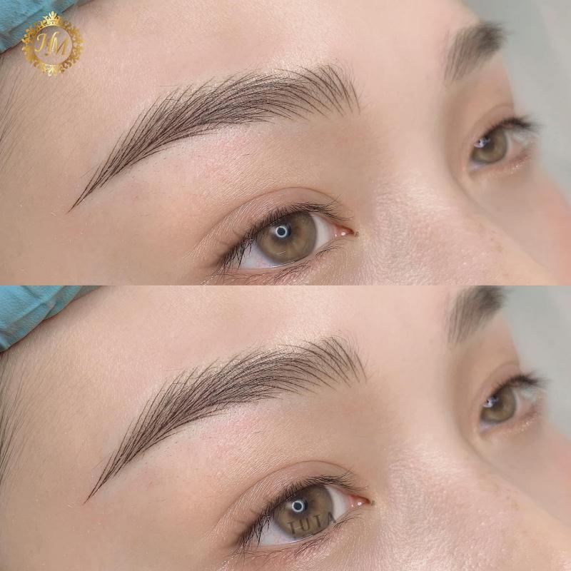 Thẩm mỹ Hương Mi