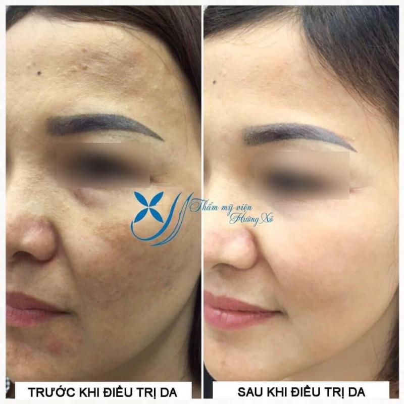 Thẩm mỹ viện Hường Xô