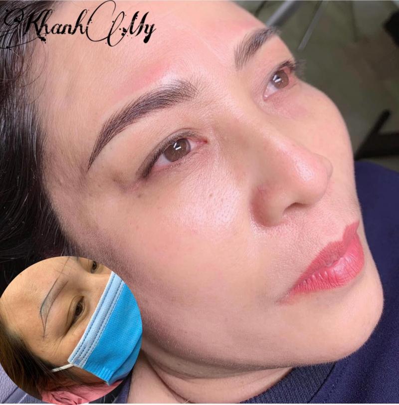 Thẩm Mỹ Khánh My