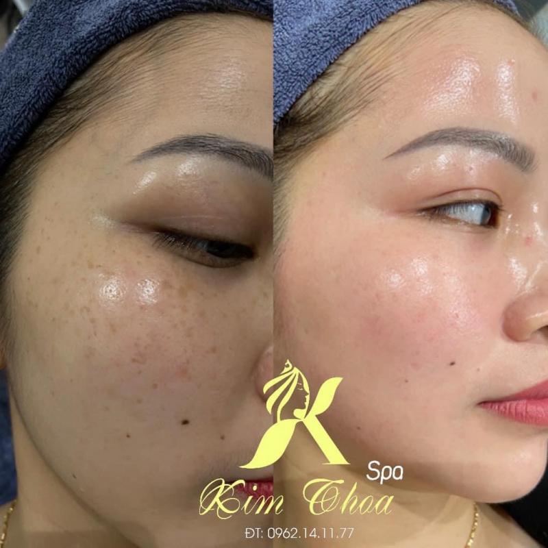 Thẩm Mỹ Kim Thoa
