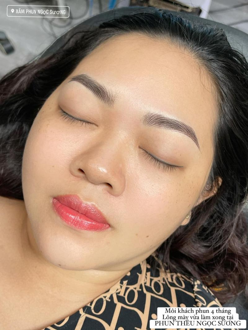 Thẩm mỹ Ngọc Sương
