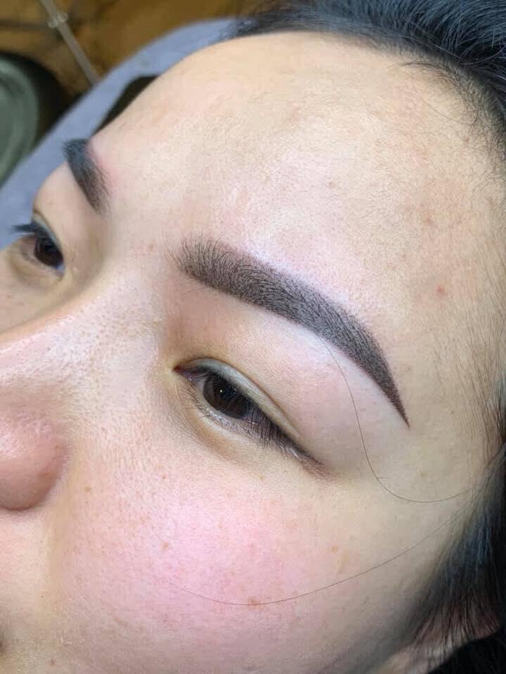 Thẩm Mỹ Nguyệt Quỳnh