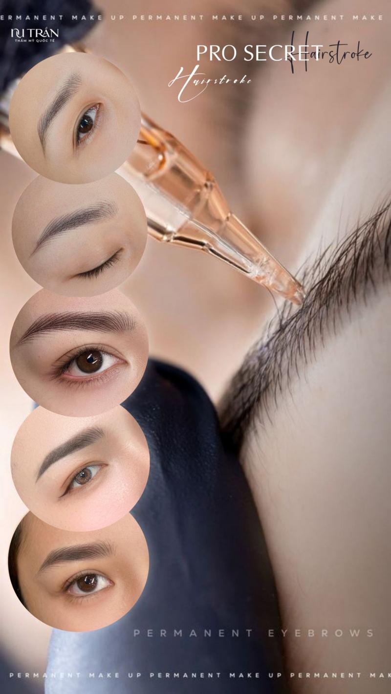 Thẩm mỹ Nụ Trần