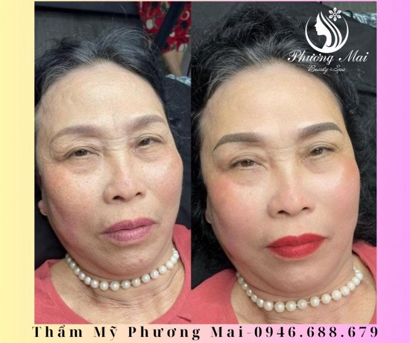 Thẩm mỹ Phương Mai