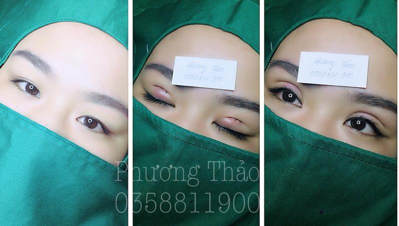 Thẩm mỹ Phương Thảo
