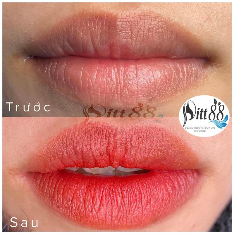 Thẩm mỹ  Pitt Beauty