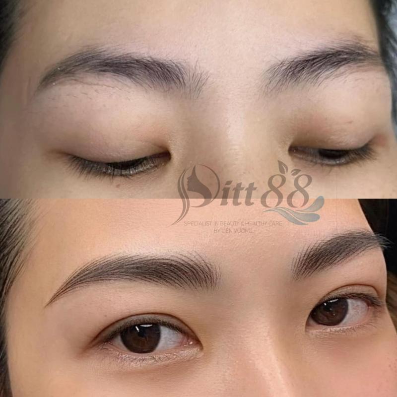 Thẩm mỹ Pitt Beauty