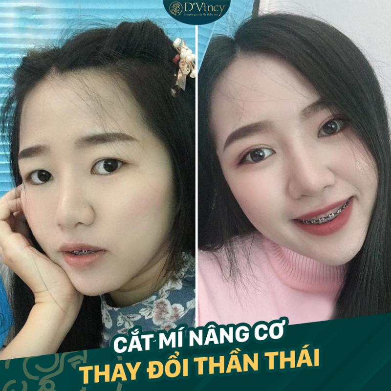 Thẩm mĩ viện D’Vincy