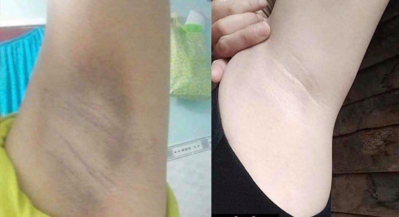 Thẩm Mỹ Quốc Tế Emmy