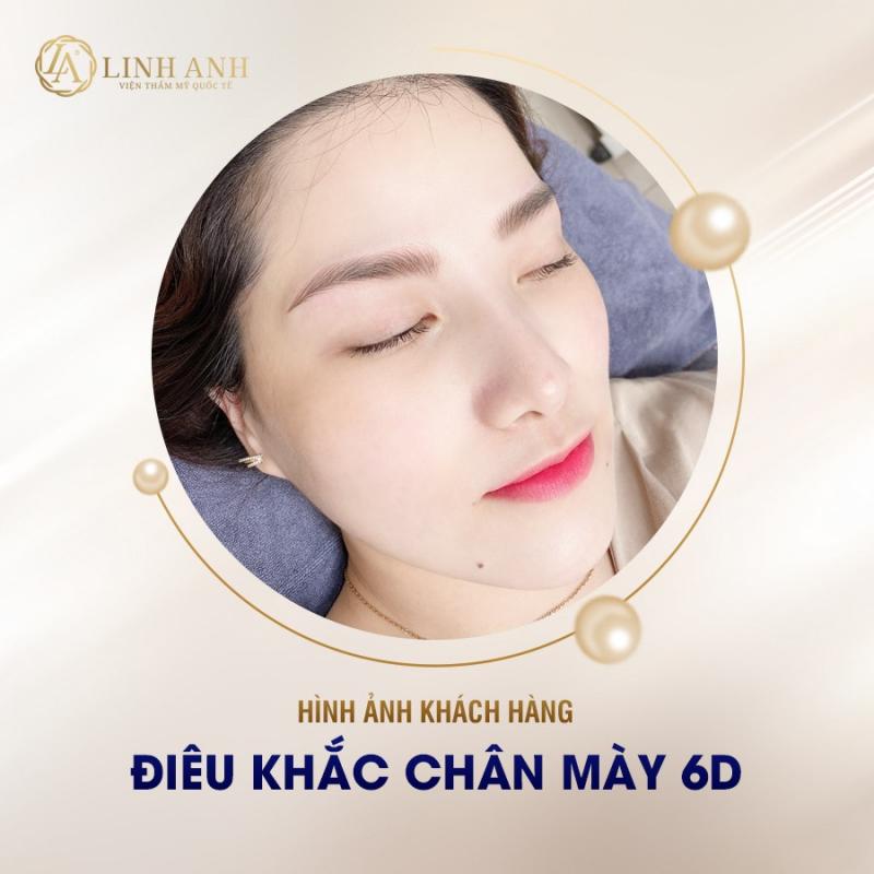 Thẩm Mỹ Quốc Tế Linh Anh