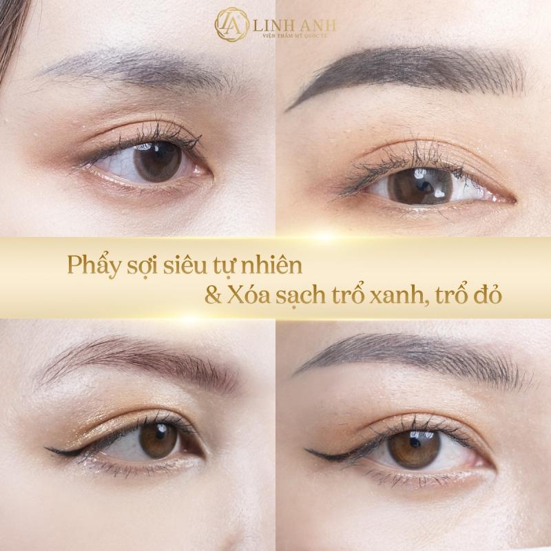 Thẩm Mỹ Quốc Tế Linh Anh - Biên Hòa