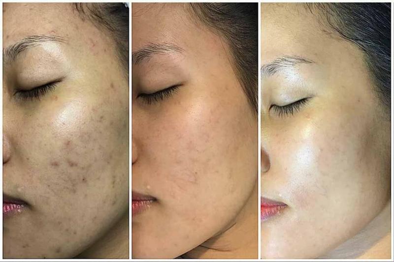 Thẩm Mỹ Quốc Tế Ngọc Huyền