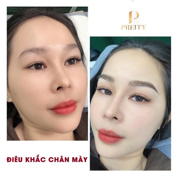 Thẩm mỹ Quốc tế Pretty