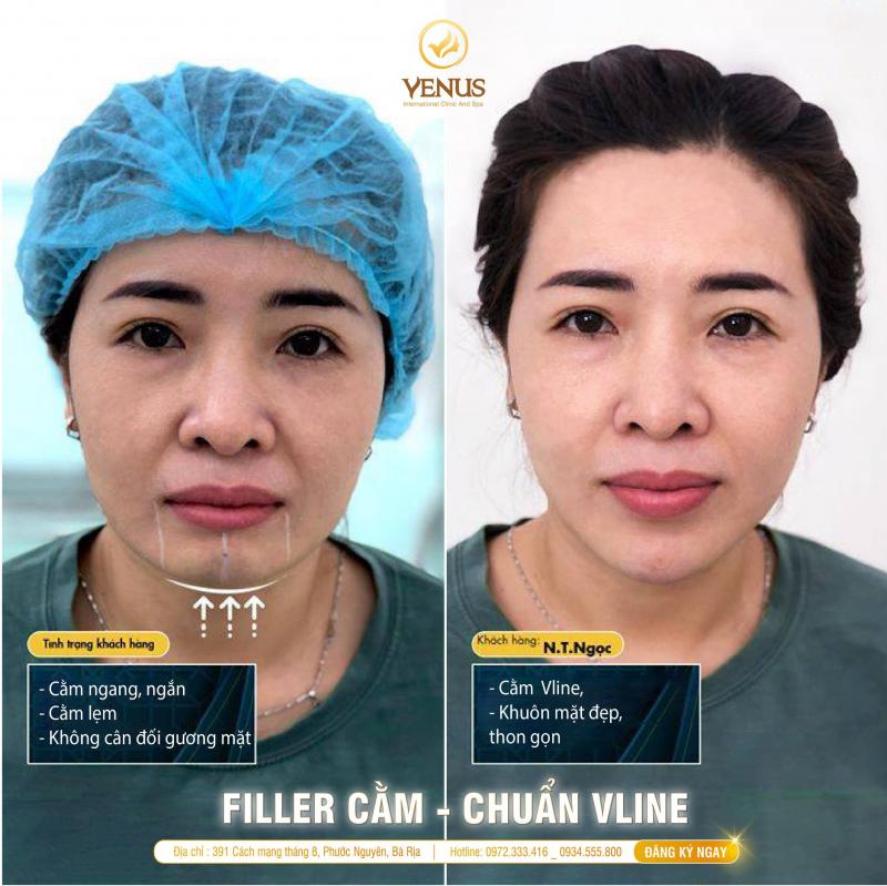 Thẩm mỹ Quốc Tế VENUS