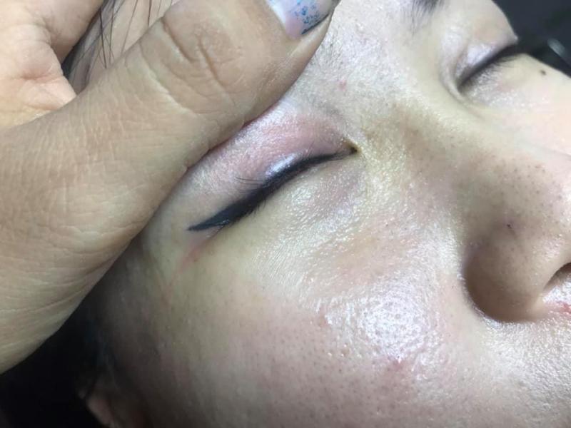 Thẩm Mỹ Sơn My