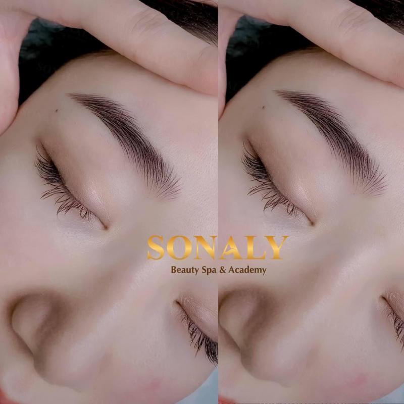 Thẩm mỹ SonaLy