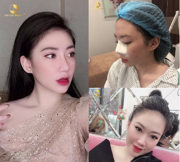 Thẩm mỹ Thu Cúc