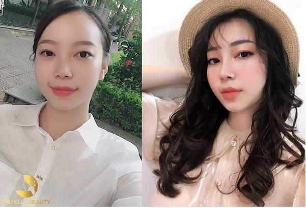 Thẩm mỹ Thu Cúc