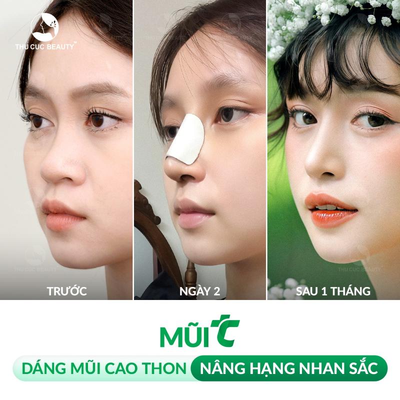Thẩm mỹ Thu Cúc Sài Gòn