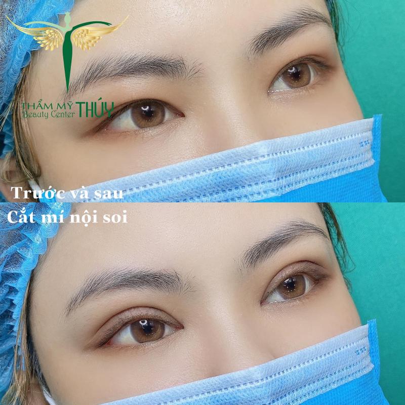 Thẩm Mỹ Thúy Beauty Center