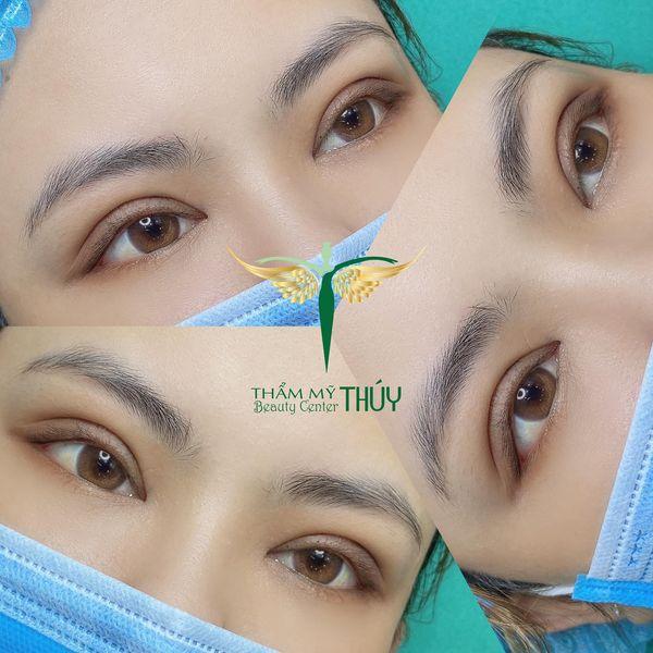 Thẩm Mỹ Thúy Beauty Center